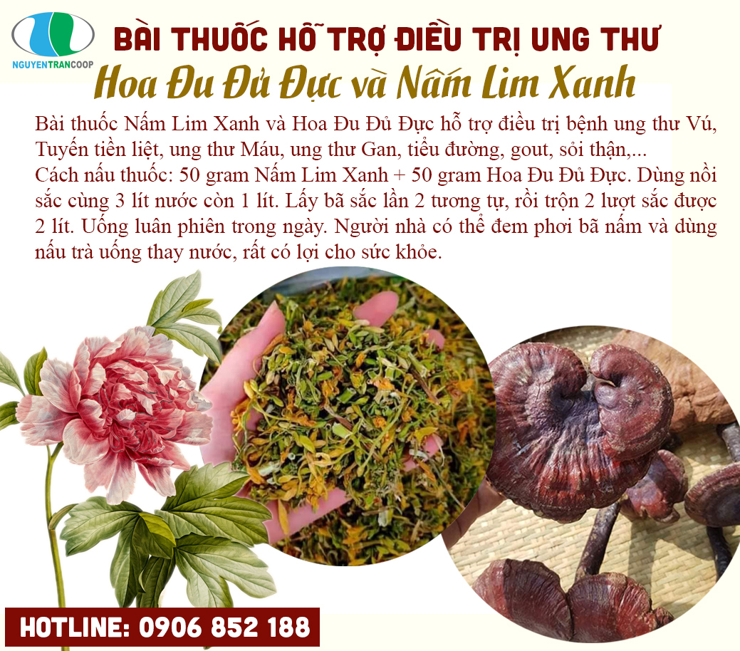 bai-thuoc-ho-tro-dieu-tri-ung-thu-giua-hoa-du-du-duc-va-nam-lim-xanh